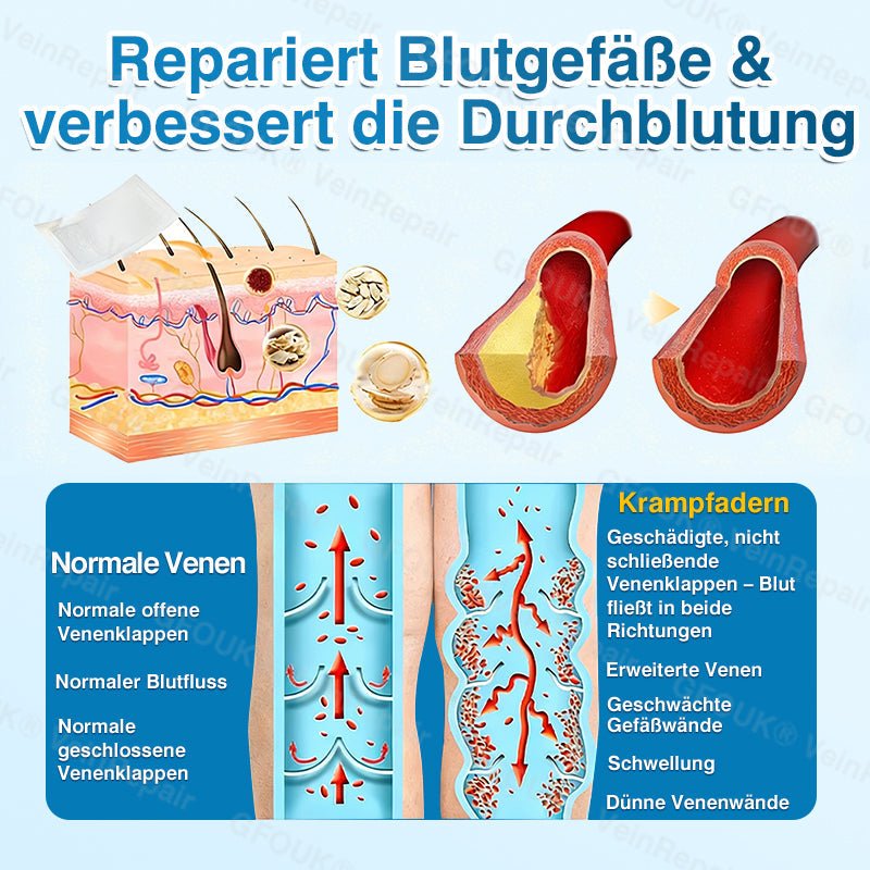 🇩🇪👨‍⚕️✅GFOUK® VeinRepair Mikronadel-Pflasterrolle⚡Sofortige Linderung, langfristige Ergebnisse
