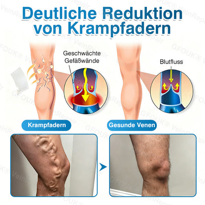 🇩🇪👨‍⚕️✅GFOUK® VeinRepair Mikronadel-Pflasterrolle⚡Sofortige Linderung, langfristige Ergebnisse
