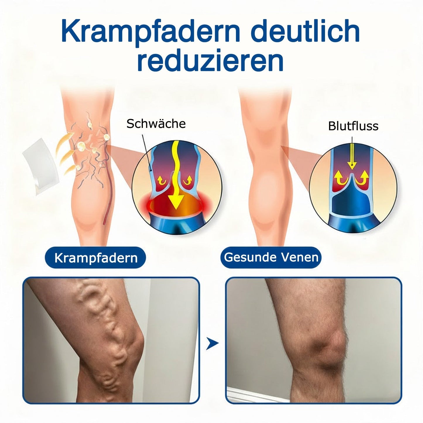 🇩🇪🩷 𝗚𝗙𝗢𝗨𝗞® 𝗩𝗲𝗶𝗻𝗧𝗮𝗿𝗴𝗲𝘁 𝗠𝗶𝗸𝗿𝗼𝗻𝗮𝗱𝗲𝗹-𝗣𝗳𝗹𝗮𝘀𝘁𝗲𝗿 ⚡ 𝗦𝗼𝗳𝗼𝗿𝘁𝗶𝗴𝗲 𝗟𝗶𝗻𝗱𝗲𝗿𝘂𝗻𝗴, 𝗟𝗮𝗻𝗴𝗳𝗿𝗶𝘀𝘁𝗶𝗴𝗲 𝗘𝗿𝗴𝗲𝗯𝗻𝗶𝘀𝘀𝗲💙