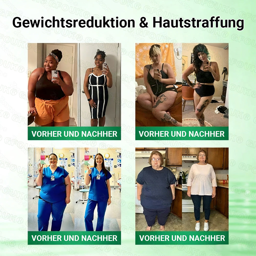 Offizieller Store 🇩🇪 |💝𝐆𝐅𝐎𝐔𝐊® Moringa · Berberin × NAD+ 10-in-1  Advanced Nano Mikronadel-Patch 🇩🇪 (Nur einmal täglich, sichtbare Veränderungen in 7 Tagen) ✅ Für Fettleibigkeit, schlaffe Haut, Diabetes, Schlafapnoe, Gelenkprobleme und mehr