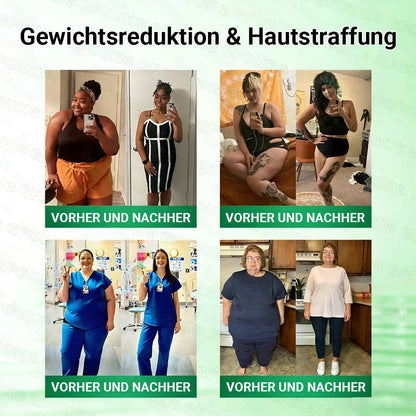 Offizieller Store 🇩🇪 |💝𝐆𝐅𝐎𝐔𝐊® Moringa · Berberin × NAD+ 10-in-1  Advanced Nano Mikronadel-Patch 🇩🇪 (Nur einmal täglich, sichtbare Veränderungen in 7 Tagen) ✅ Für Fettleibigkeit, schlaffe Haut, Diabetes, Schlafapnoe, Gelenkprobleme und mehr