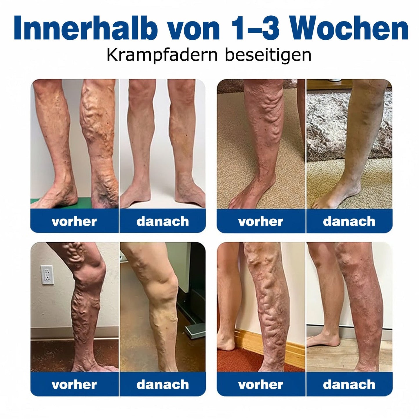 🇩🇪🩷 𝗚𝗙𝗢𝗨𝗞® 𝗩𝗲𝗶𝗻𝗧𝗮𝗿𝗴𝗲𝘁 𝗠𝗶𝗸𝗿𝗼𝗻𝗮𝗱𝗲𝗹-𝗣𝗳𝗹𝗮𝘀𝘁𝗲𝗿 ⚡ 𝗦𝗼𝗳𝗼𝗿𝘁𝗶𝗴𝗲 𝗟𝗶𝗻𝗱𝗲𝗿𝘂𝗻𝗴, 𝗟𝗮𝗻𝗴𝗳𝗿𝗶𝘀𝘁𝗶𝗴𝗲 𝗘𝗿𝗴𝗲𝗯𝗻𝗶𝘀𝘀𝗲💙
