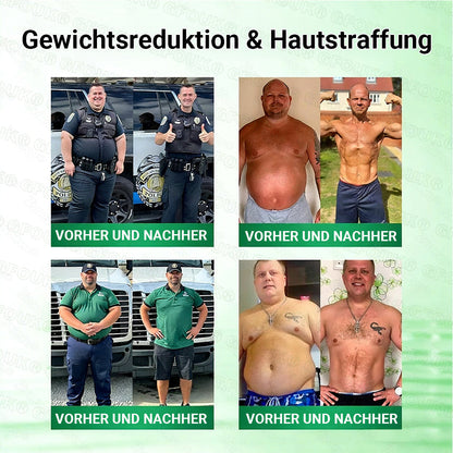 Offizieller Store 🇩🇪 |💝𝐆𝐅𝐎𝐔𝐊® Moringa · Berberin × NAD+ 10-in-1  Advanced Nano Mikronadel-Patch 🇩🇪 (Nur einmal täglich, sichtbare Veränderungen in 7 Tagen) ✅ Für Fettleibigkeit, schlaffe Haut, Diabetes, Schlafapnoe, Gelenkprobleme und mehr