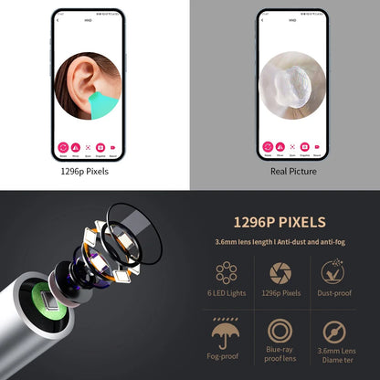 Intelligenter Ohrreiniger mit Kamera – sicher & effektiv